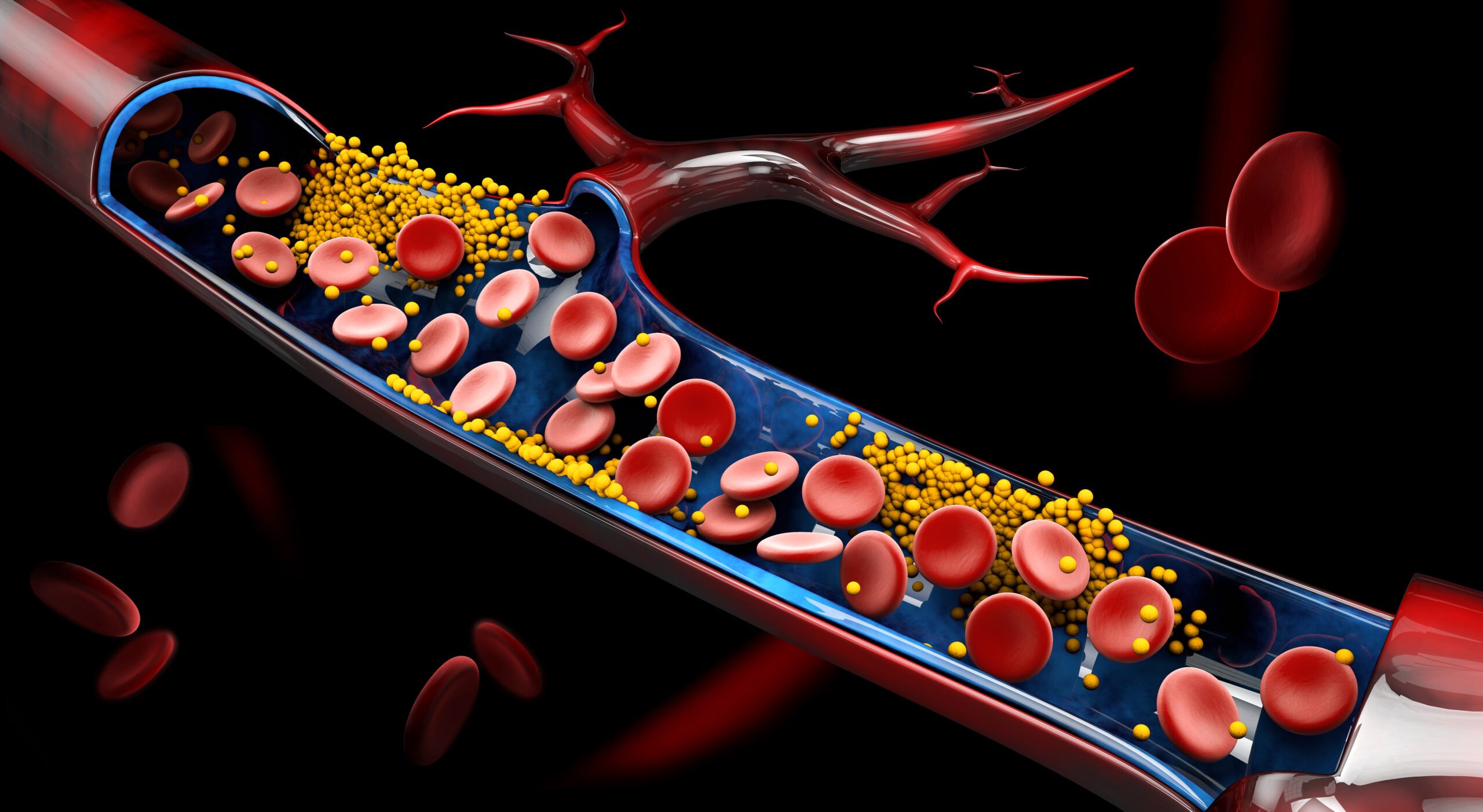 Lipid Panel / Cardiac Risk Profile