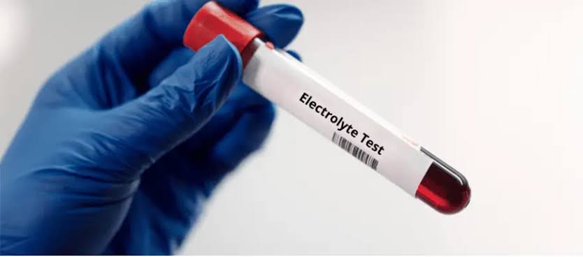 Serum Electrolytes (Sodium, Potassium, Chloride)